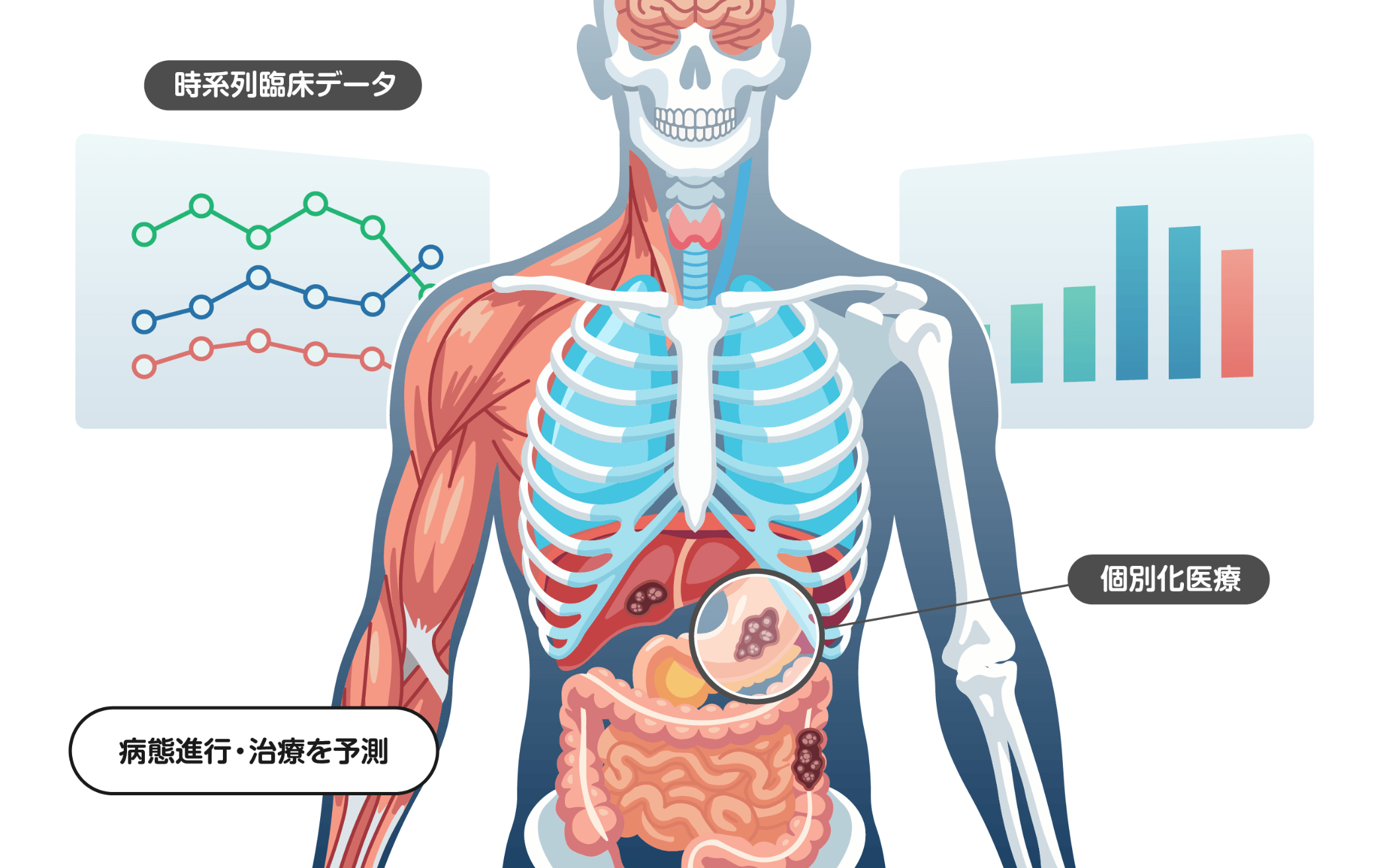 時系列臨床データ、病態進行・治療を予測、個別化医療